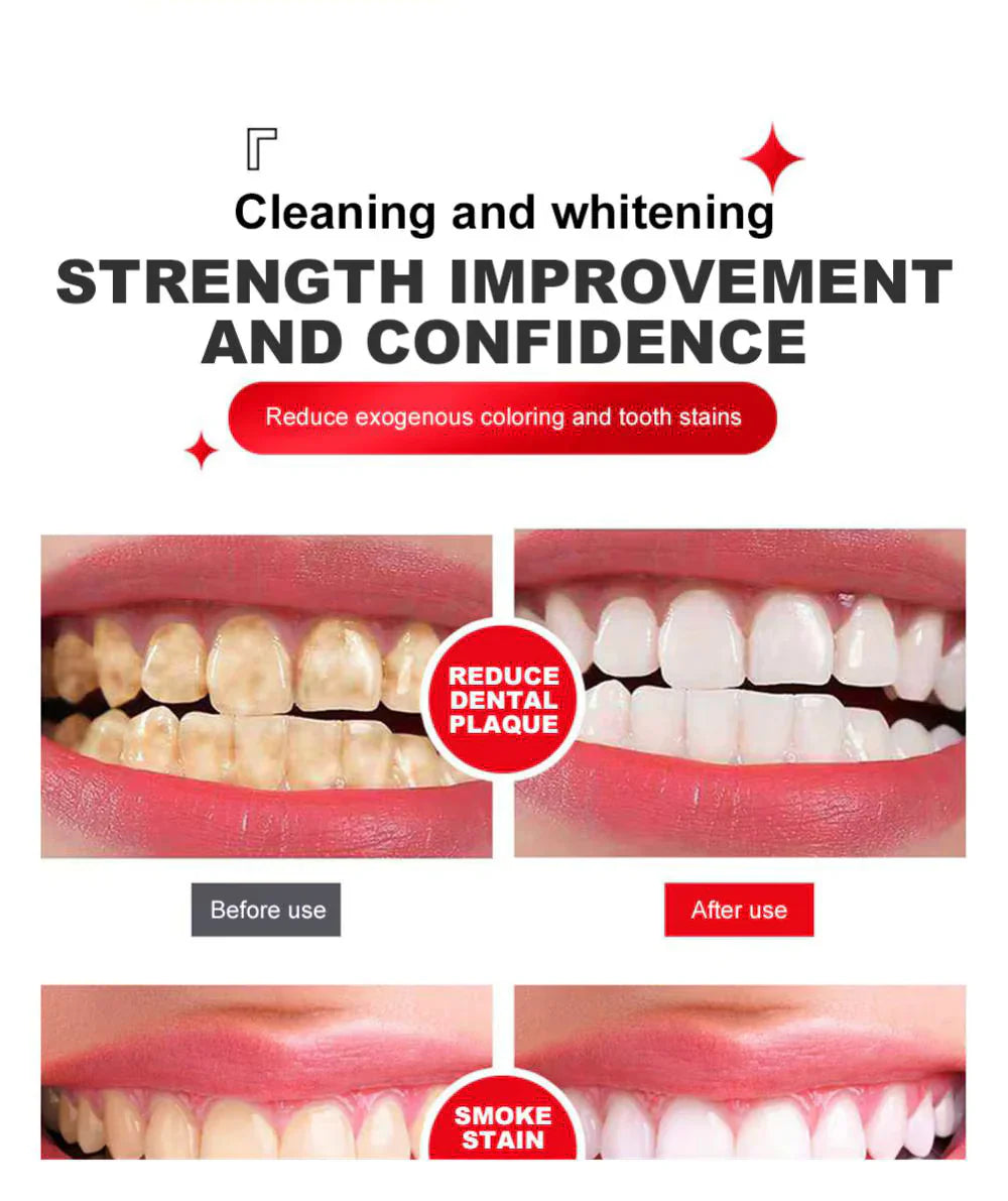 Yayashi SP4 Probiotic Whitening Toothpaste 120g – Removes Coffee, Tea & Smoking Stains