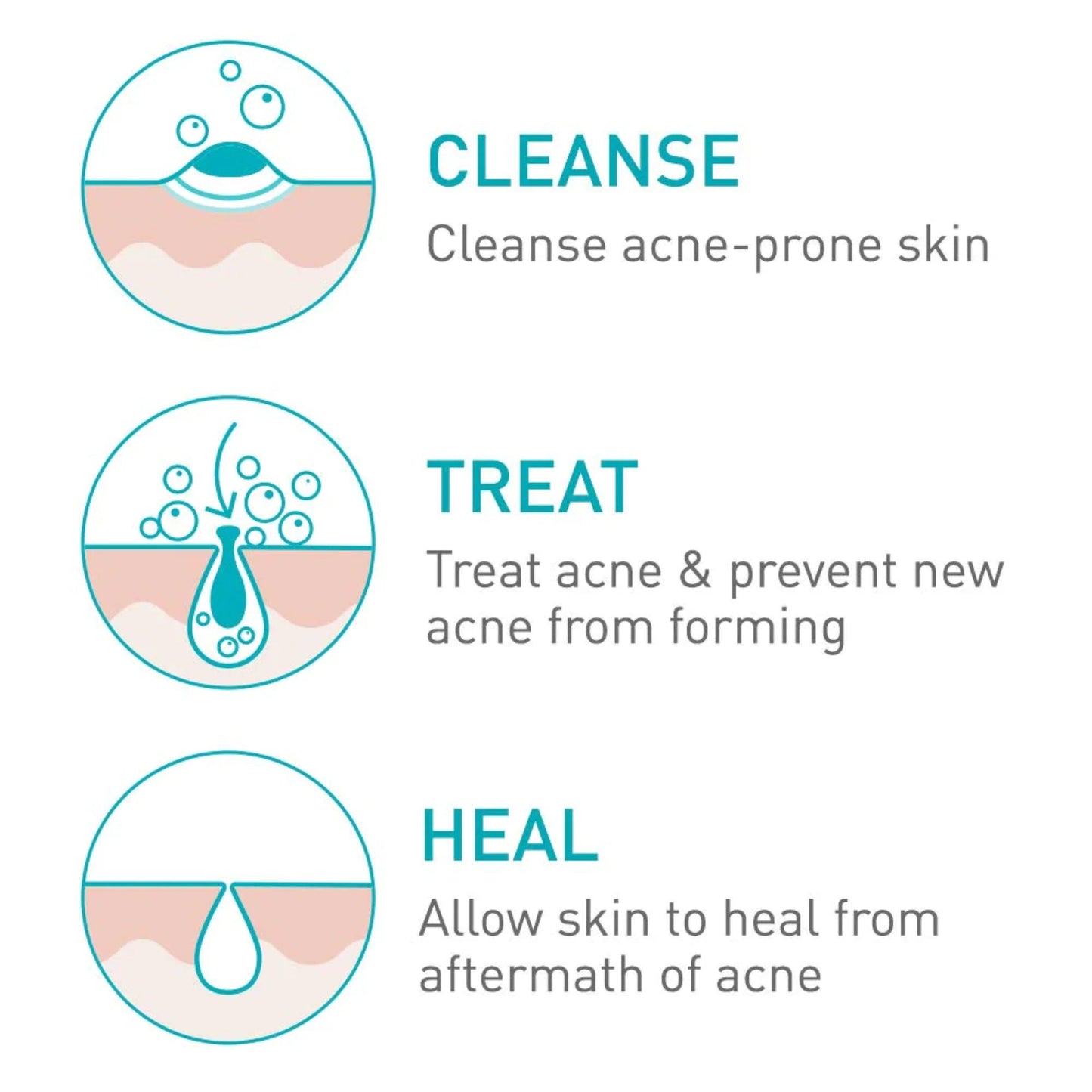 Acne Foaming Cream Cleanser