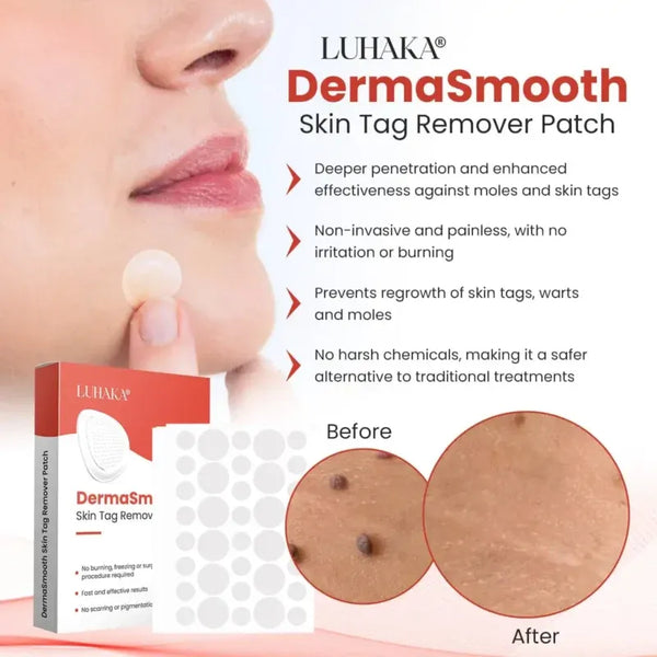Derma Smooth Skin Tag Removal Patch | BUY ONE GET ONE FREE