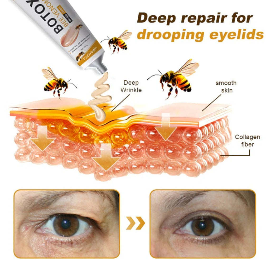 Botox Bee Venom Wrinkle Removal Cream (BUY ONE GET ONE FREE)