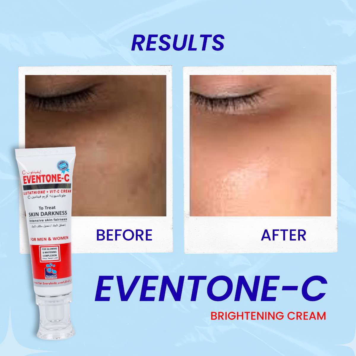 Eventone C Cream ( Skin whitening ) BUY ONE GET ONE FREE